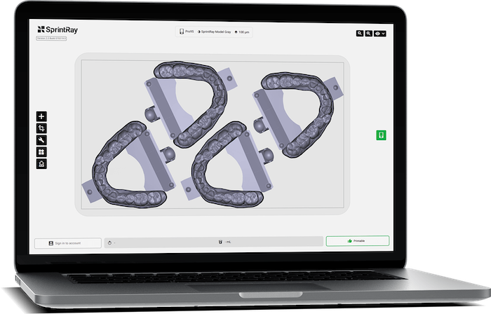 SprintRay Software dental