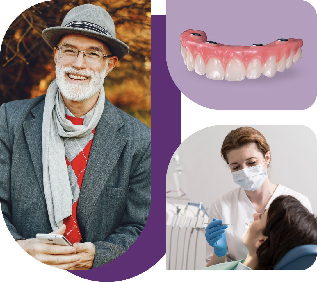 All-on-4 Full Mouth Dental Implants, Florence