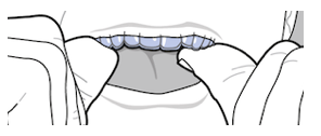 Invisalign to Work