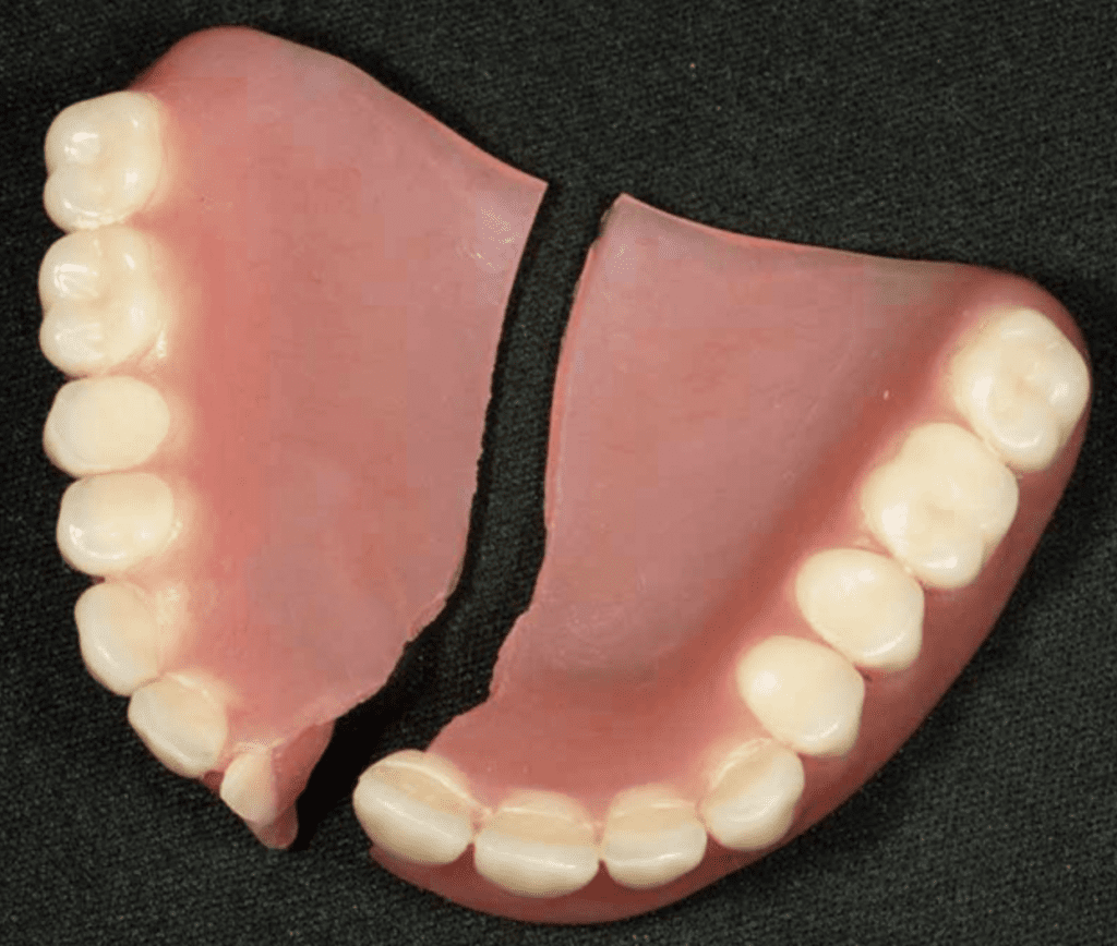 Risk of Damaging Dentures