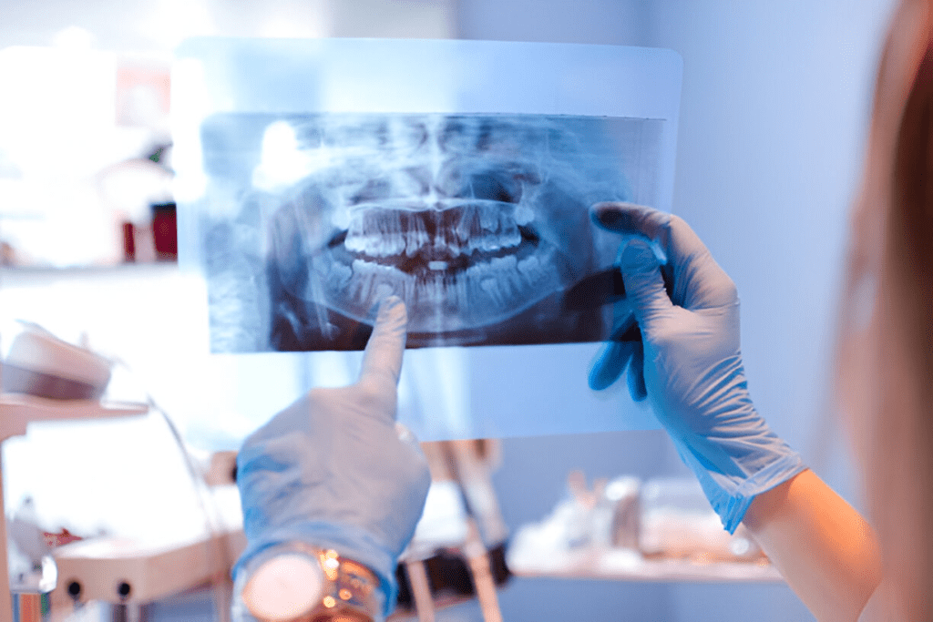 dental X-rays