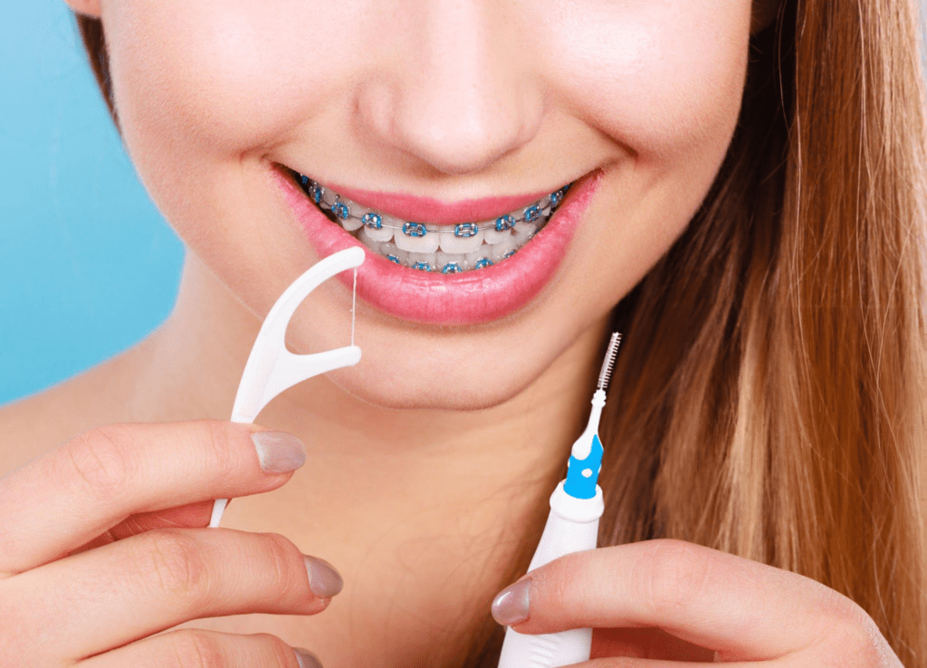 cleaning teeth with spacers