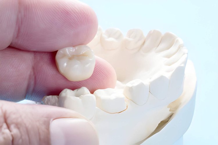 teeth crowns