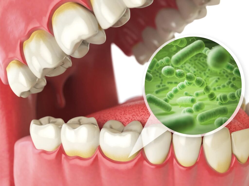 Eliminates bacteria