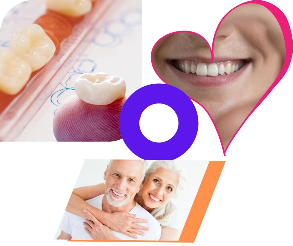 Dental Crown Costs