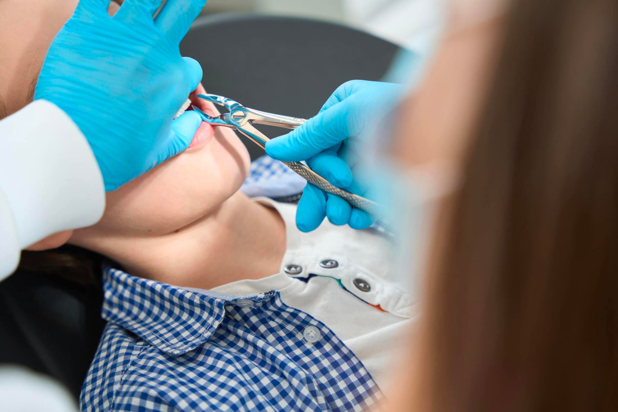 Tooth extractions