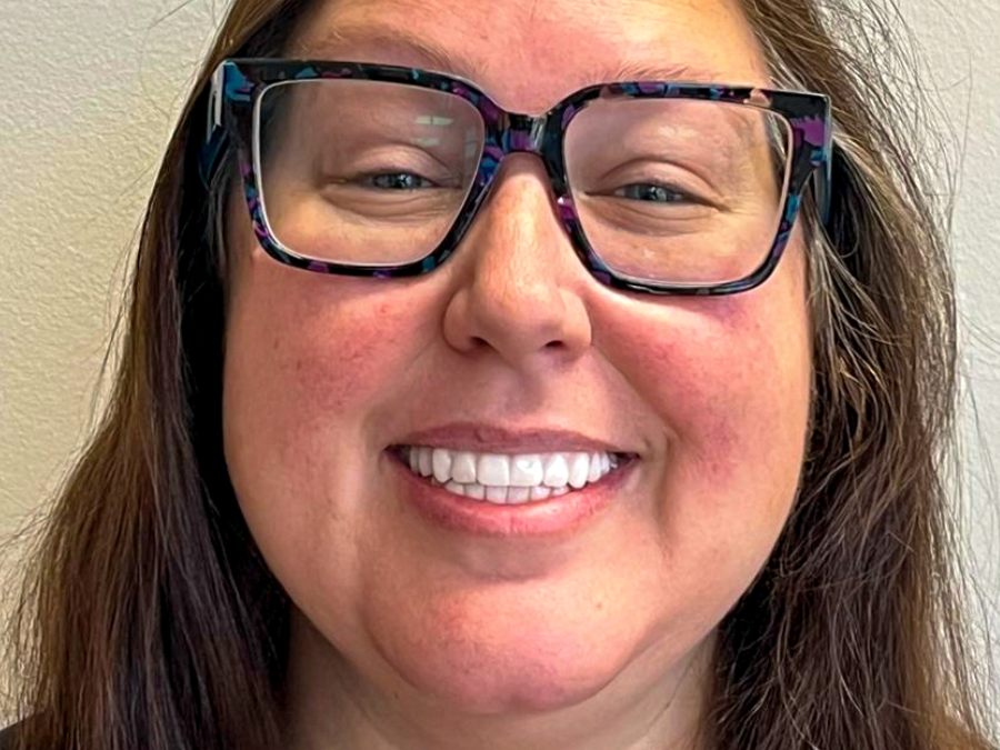 After — cosmetic dentistry by Dr. Westermeier at Wellness Dental Glendale