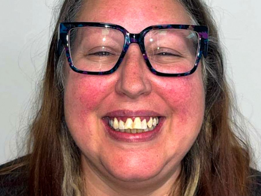Before — cosmetic dentistry case treated by Dr. Westermeier at Wellness Dental Glendale